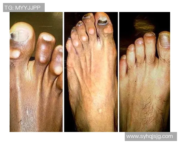 足球明星脚趾的秘密：从每一步到突破极限的背后力量